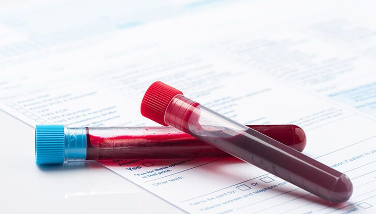 Biochemical Analysis