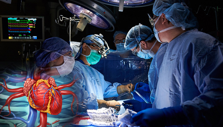 Cardiac Surgery