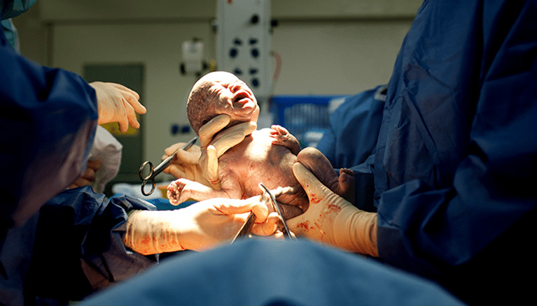 OBS and Gynaecology