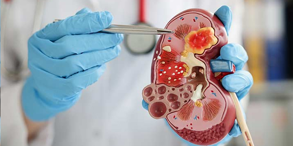 Nephrology & Dialysis Services Banner
